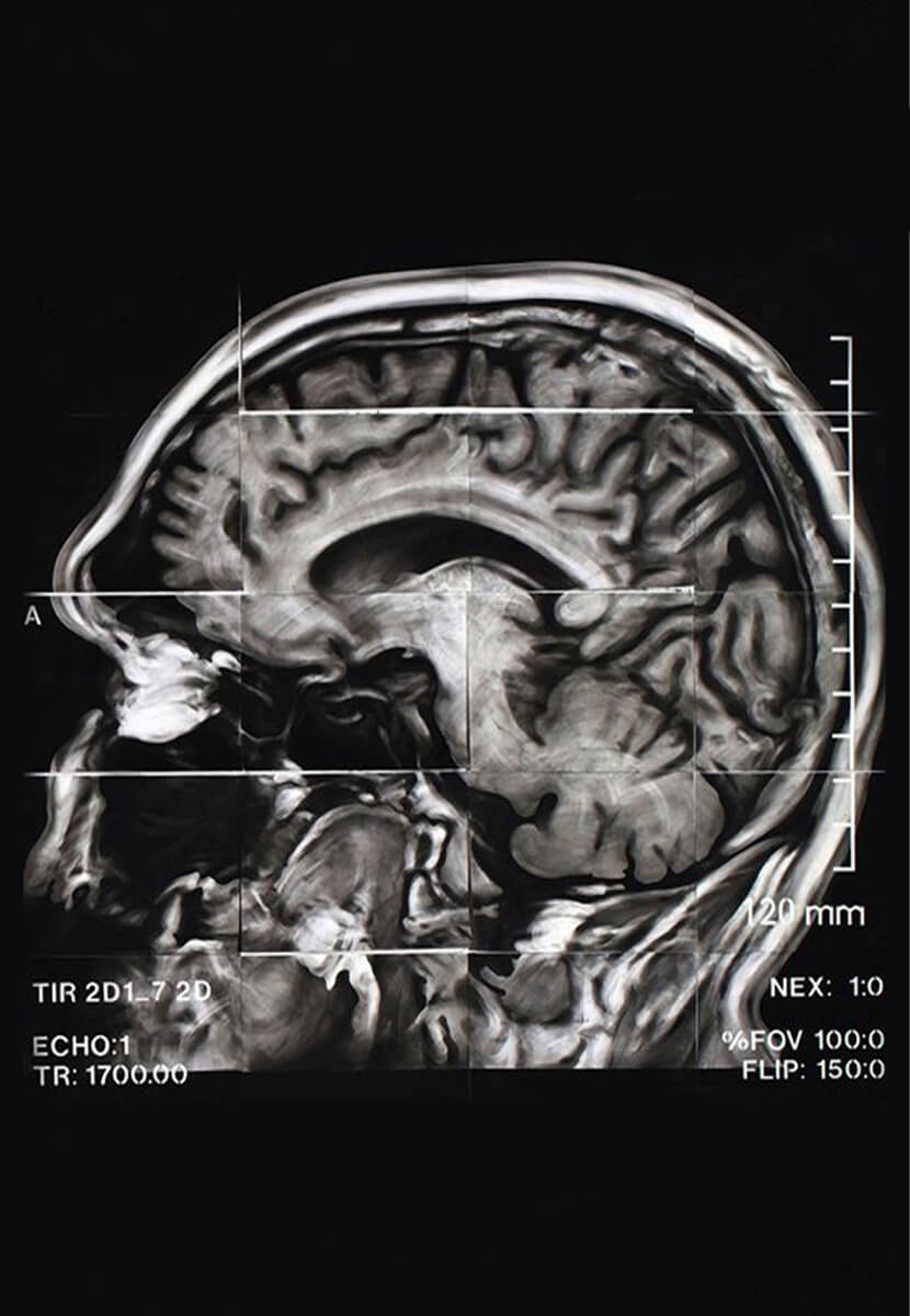 Bir Delinin Hatıra Defteri - Oğuzhan Karadavut